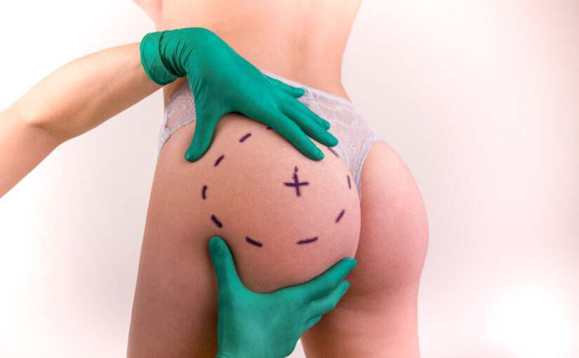 Post-Op Liposuction Recovery in Seattle. Post Lipo Lymphatic Drainage, Massage. Fibrosis Massage, Lymphatic Massage Near Me.