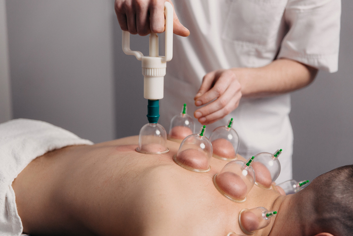 Cupping Massage, Cupping Therapy, Uma Clinic in Seattle