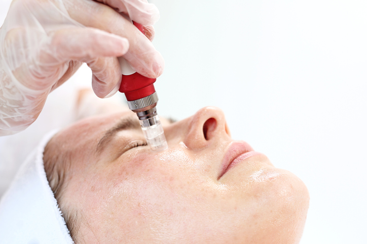 Microneedling Skin Tightening at Uma Clinic in Seattle