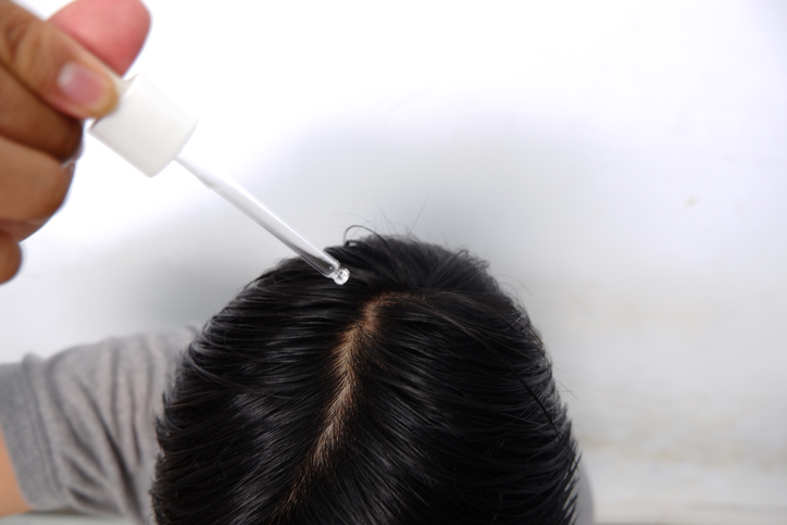 Microneedle for Hair Growth at Uma clinic in Seattle