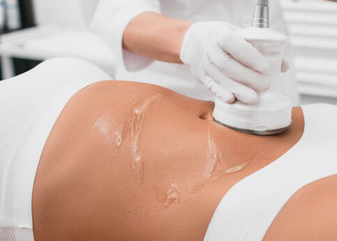 Beautiful woman having cavitation , cellulite treatment, on her belly at beauty clinic
